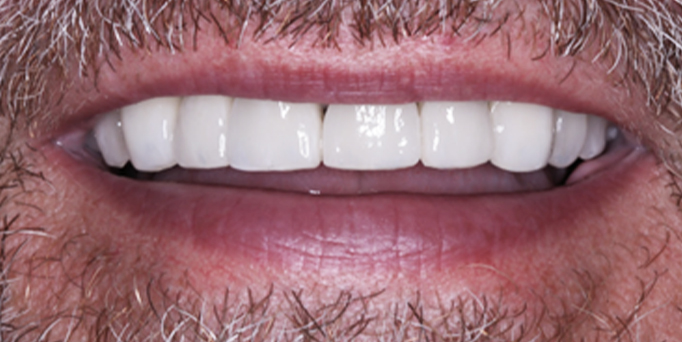 After- image - Serio Dental