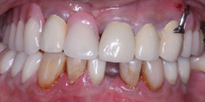 After- image - Serio Dental