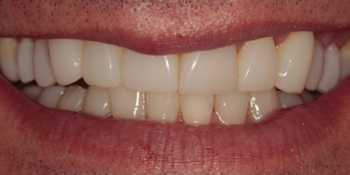 After- image - Serio Dental