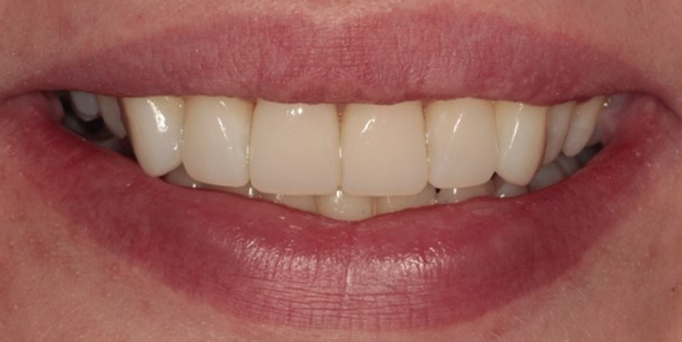 After- image - Serio Dental