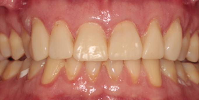 After- image - Serio Dental