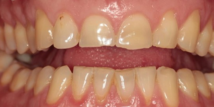 Before - Image - Serio Dental