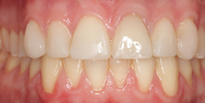 After- image - Serio Dental