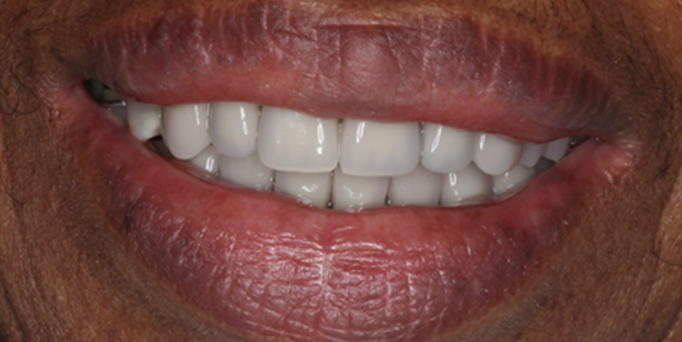 After- image - Serio Dental