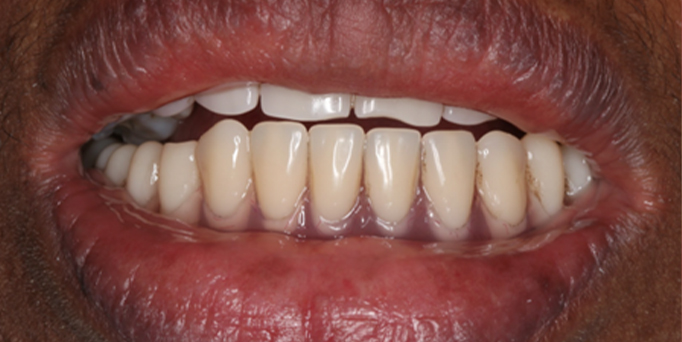 Before - Image - Serio Dental