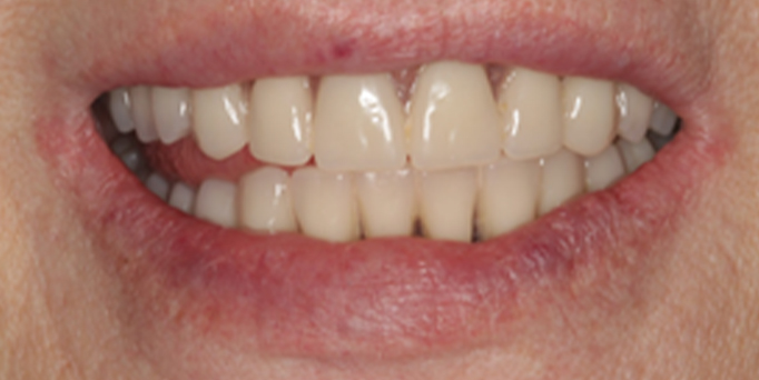 Before - Image - Serio Dental