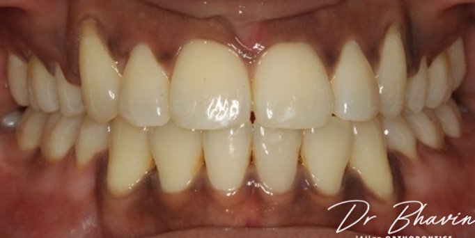 After- image - Serio Dental