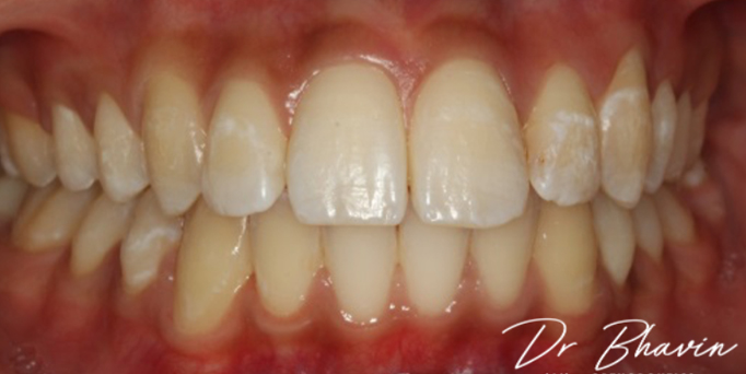 After- image - Serio Dental