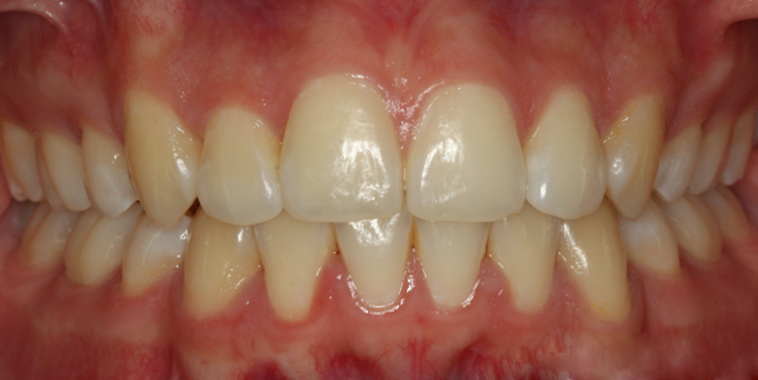 After- image - Serio Dental