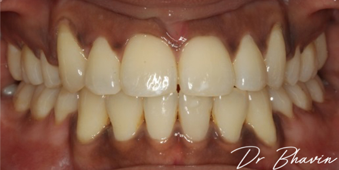 After- image - Serio Dental