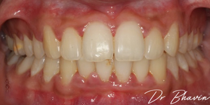 After- image - Serio Dental