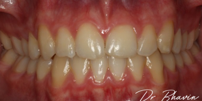 After- image - Serio Dental