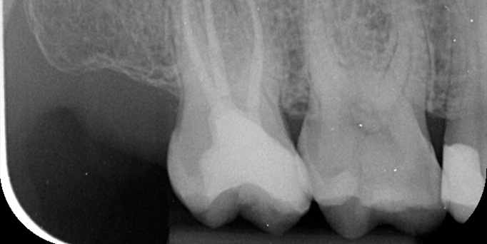 After- image - Serio Dental