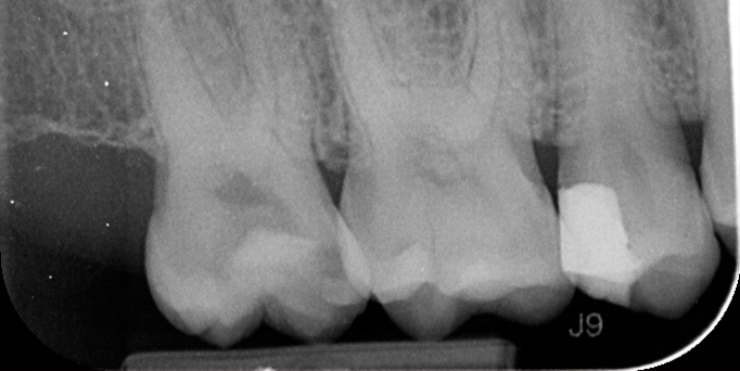 Before - Image - Serio Dental