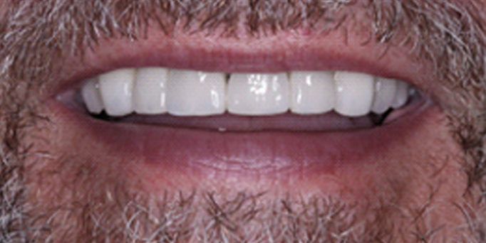 After- image - Serio Dental