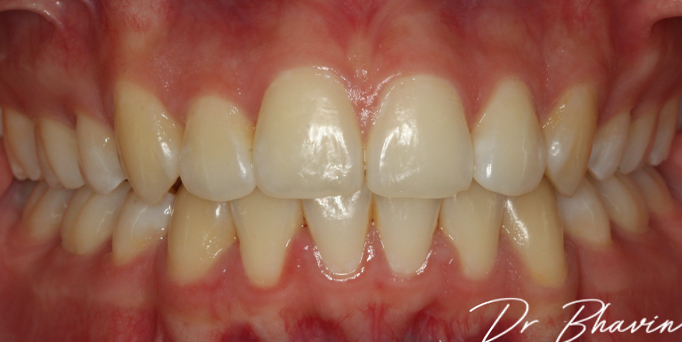 After- image - Serio Dental